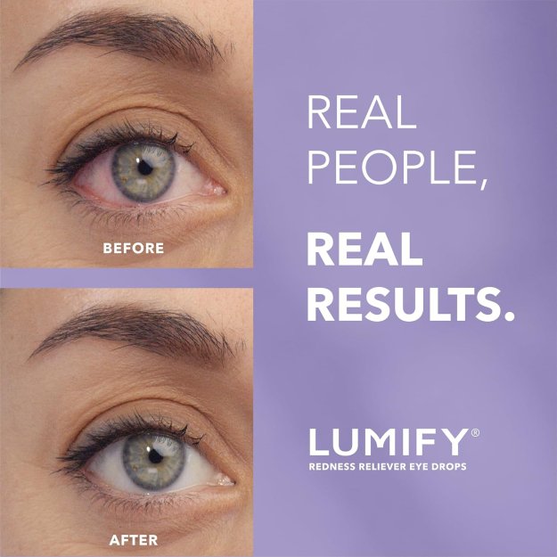 LUMIFY Redness Reliever Eye Drops, For Whiter & Brighter Looking Eyes, 0.08 Fl Oz (2.5 mL)